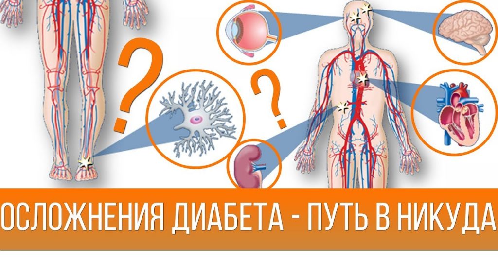 Сахарный диабет картинки прикольные